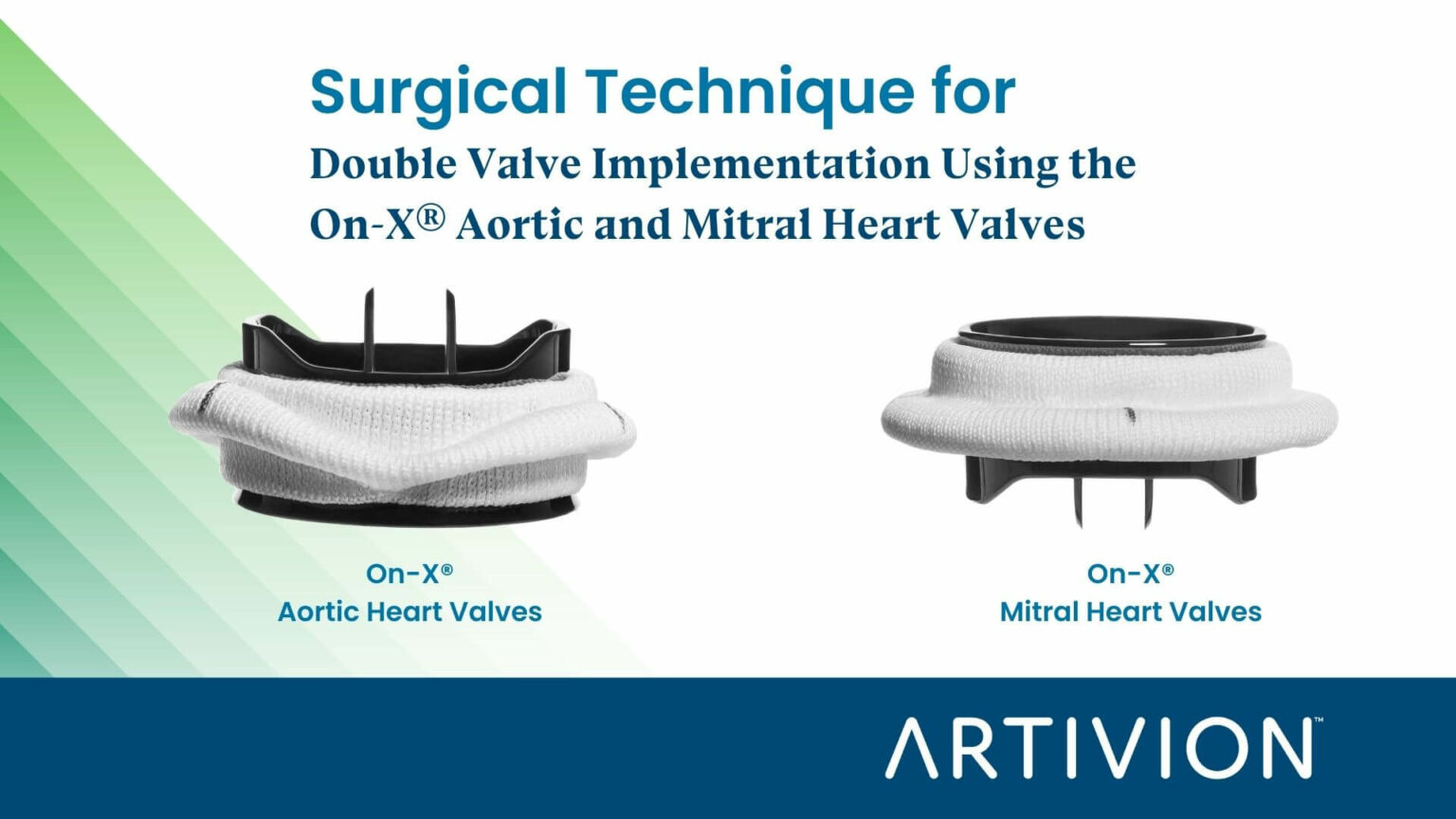 Surgical Technique for OnX® Aortic Heart Valve Implantation Heart